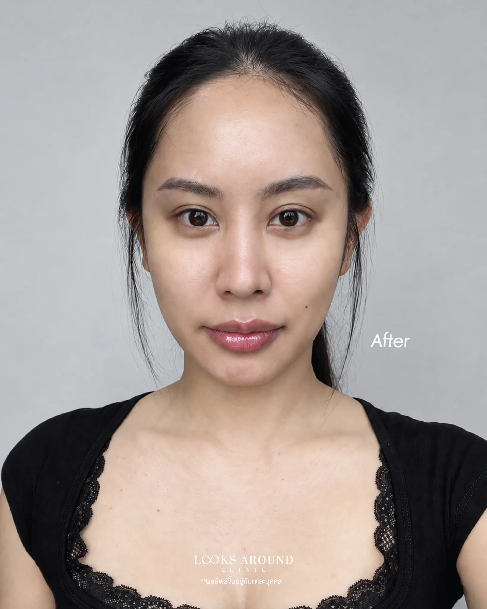 ภาพหลังทำ